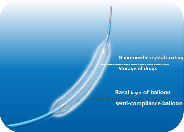 Drug Coated Coronary Balloon.png